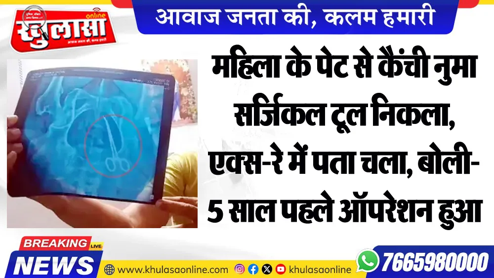 महिला के पेट से कैंची नुमा सर्जिकल टूल निकला, एक्स-रे में पता चला, बोली- 5 साल पहले ऑपरेशन हुआ