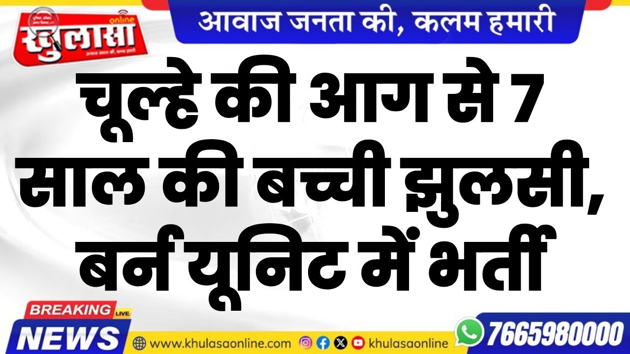 चूल्हे की आग से 7 साल की बच्ची झुलसी, बर्न यूनिट में भर्ती